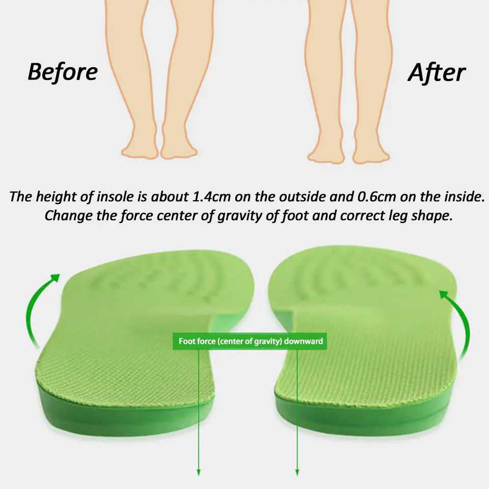O-Shaped PU Foam Insole for Foot Valgus Correction