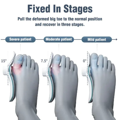 Orthopedic Toe Alignment Brace